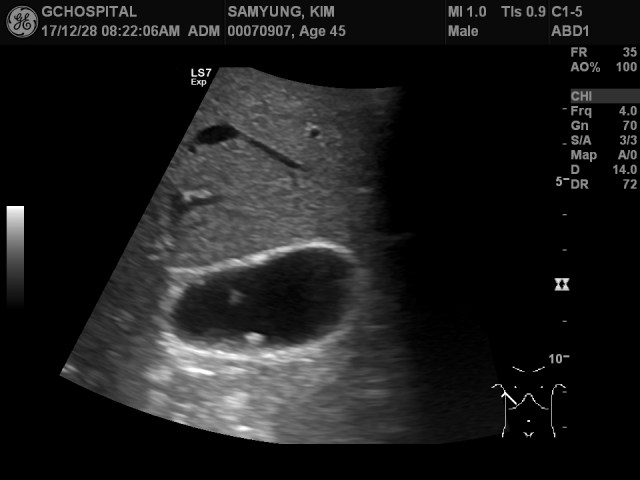 00070907_US_2017122888_20171228_004