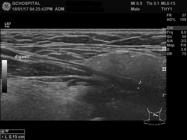 00064259_US_20180117279_20180117_008