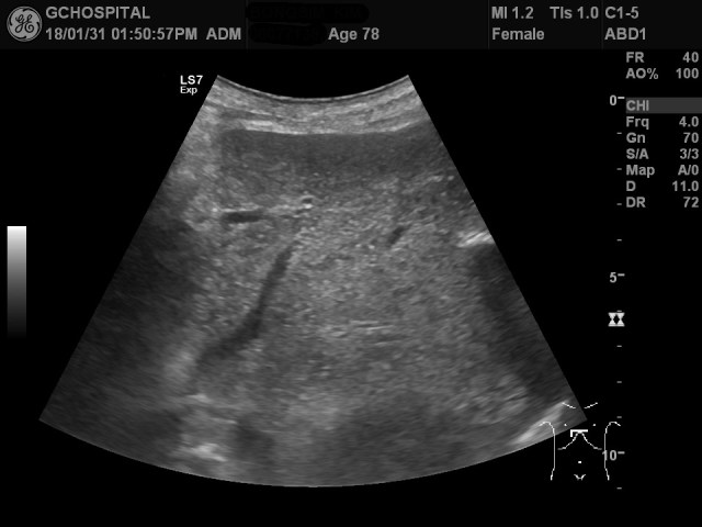 00077138_US_20180131362_20180131_002