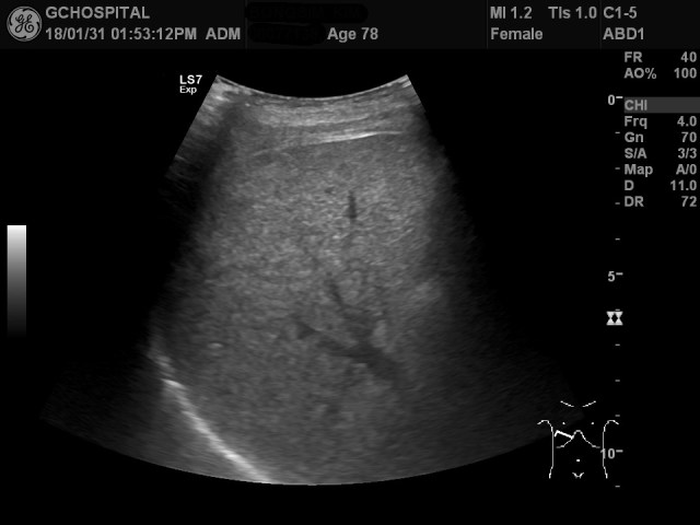 00077138_US_20180131362_20180131_005