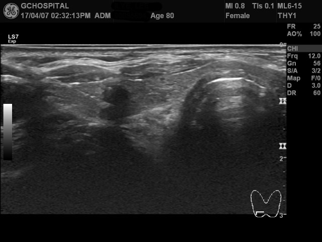 00095894_US_20170407385_20170407_001