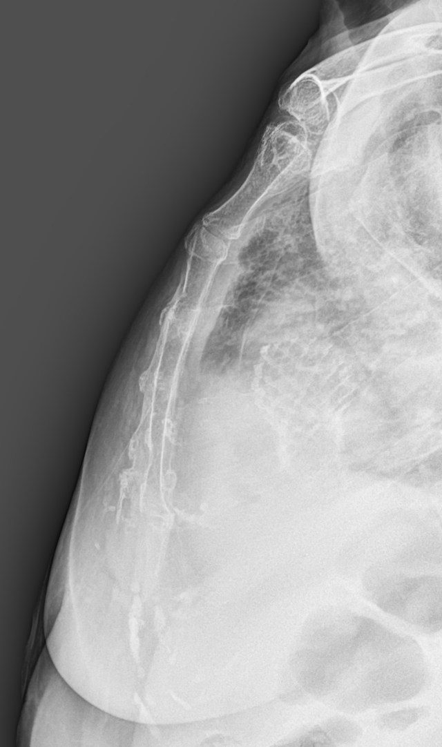 00123826_CR_20180112432_20180112_001