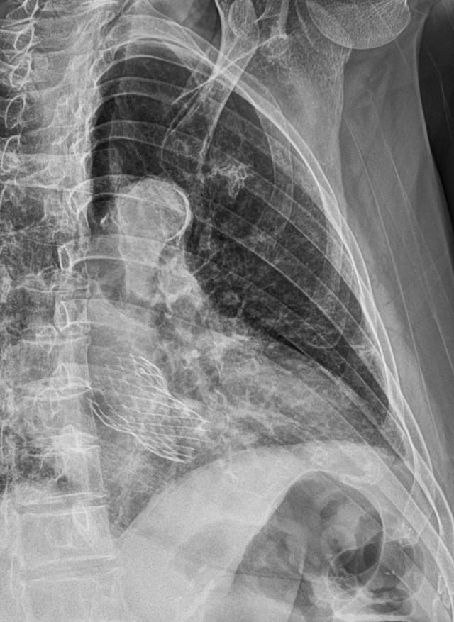 00123826_CR_20180112432_20180112_002