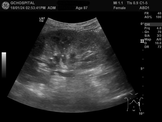 00145382_US_20180124380_20180124_002