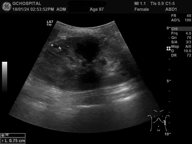 00145382_US_20180124380_20180124_003