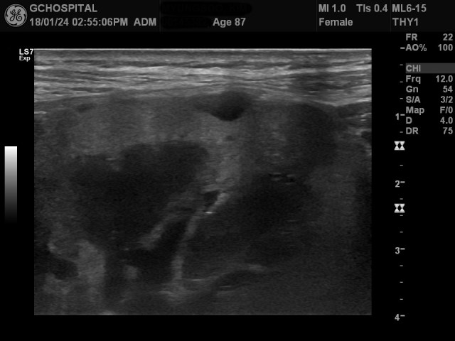 00145382_US_20180124380_20180124_004