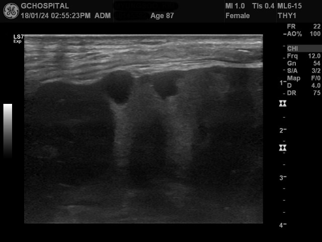 00145382_US_20180124380_20180124_005