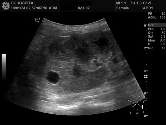 00145382_US_20180124380_20180124_008