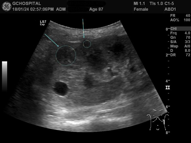 00145382_US_20180124380_20180124_009