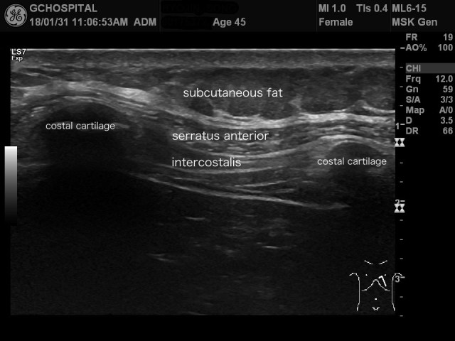 00175372_US_20180131297_20180131_002