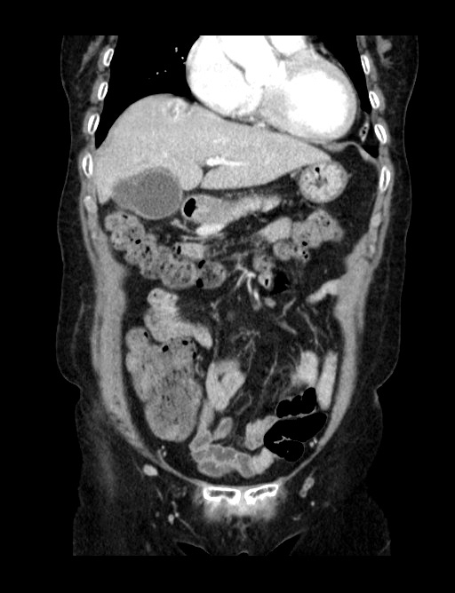 00204973_CT_20180103115_20180103_004