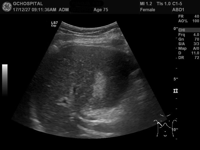 00204973_US_20171227150_20171227_002