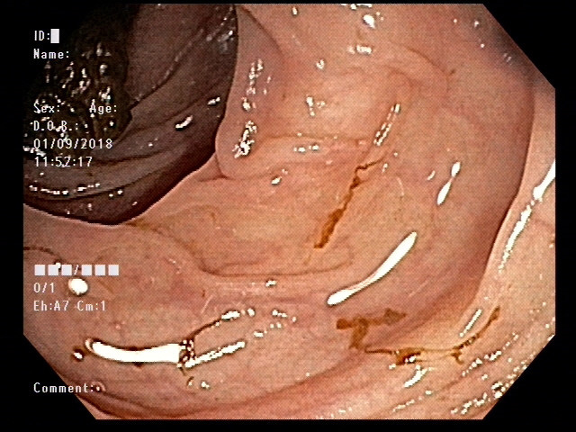 00243492_ES_20180109312_20180109_006