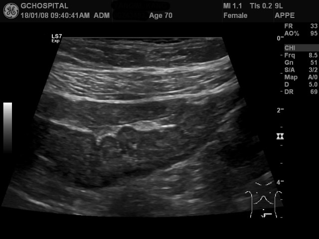 00243492_US_20180108184_20180108_001