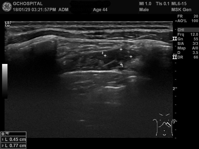 00249776_US_20180129472_20180129_001 1