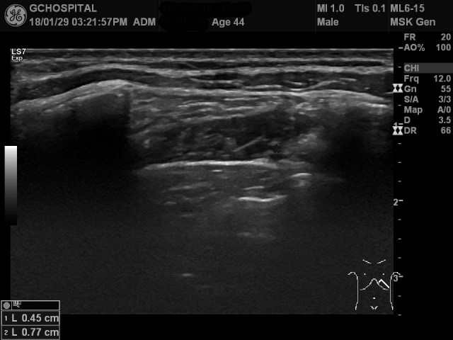 00249776_US_20180129472_20180129_001