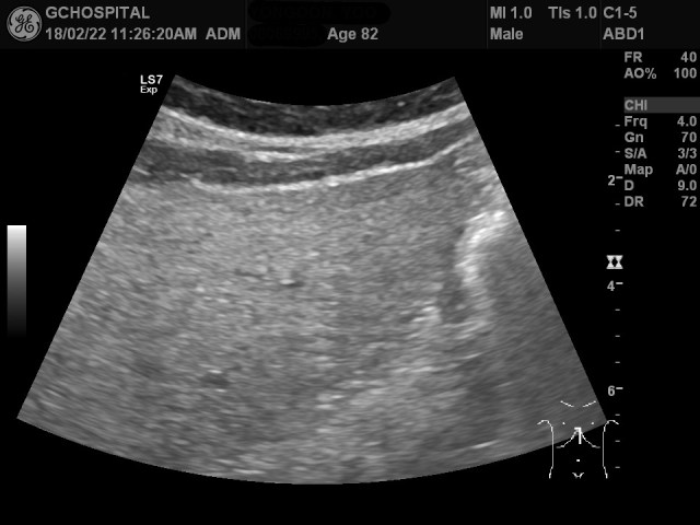 00069995_US_20180222338_20180222_001