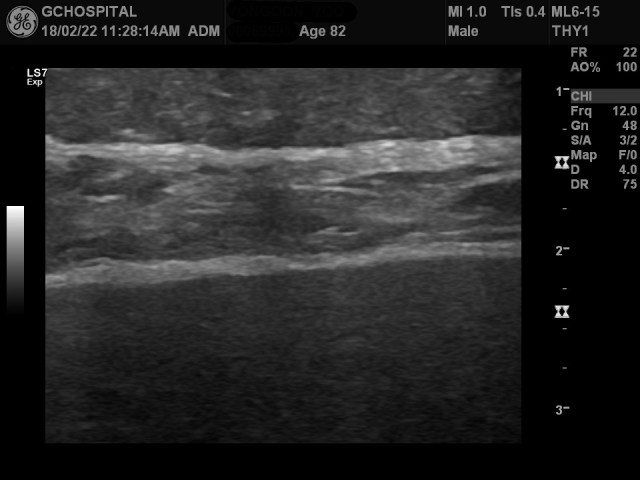 00069995_US_20180222338_20180222_003