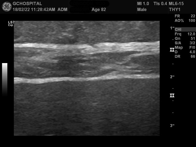 00069995_US_20180222338_20180222_004