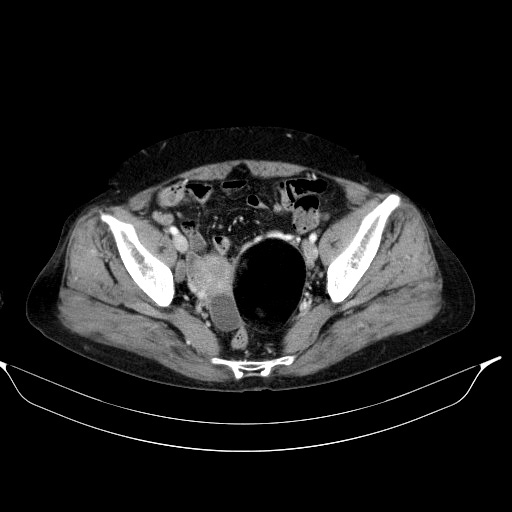 00070346_CT_20180210144_20180210_002