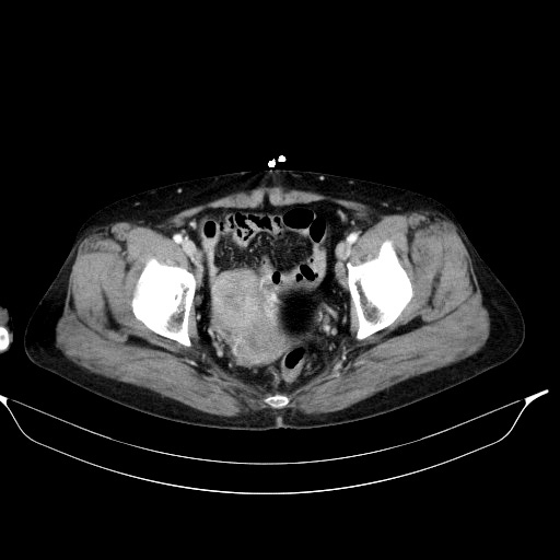 00070346_CT_20180210144_20180210_003