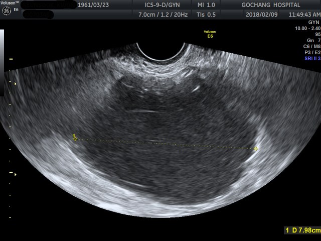 00070346_US_20180209312_20180209_005