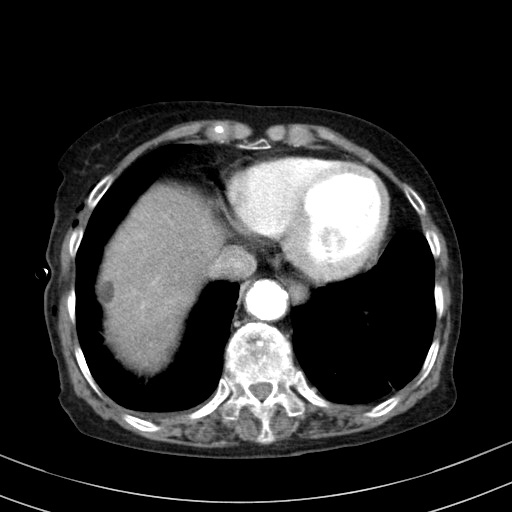 00161944_CT_20170919128_20170919_001