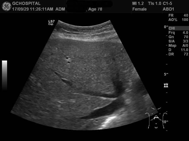 00161944_US_20170929297_20170929_004