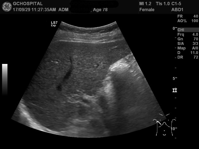 00161944_US_20170929297_20170929_005