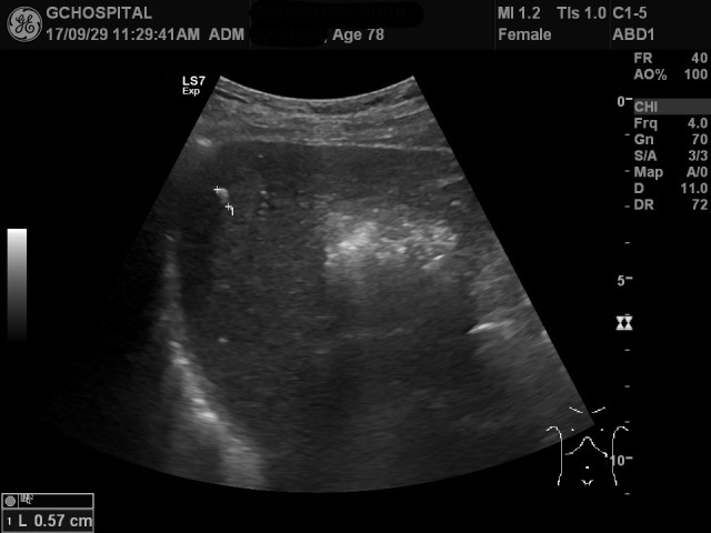 00161944_US_20170929297_20170929_006