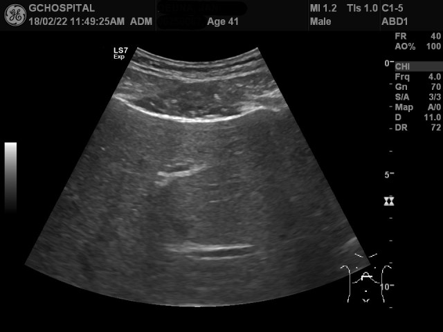 00250067_US_20180222344_20180222_006