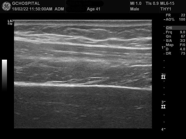 00250067_US_20180222344_20180222_007