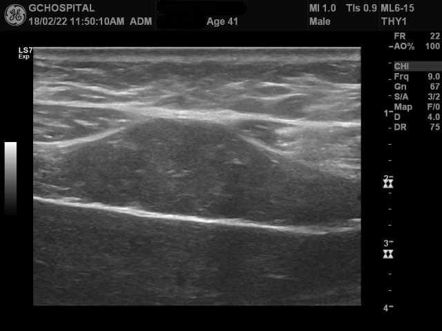 00250067_US_20180222344_20180222_008