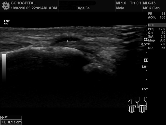 00109311_US_20180210166_20180210_002