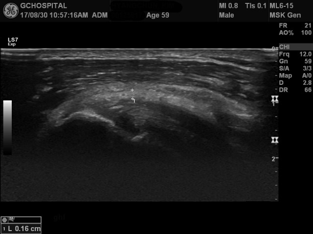 00125817_US_20170830276_20170830_001