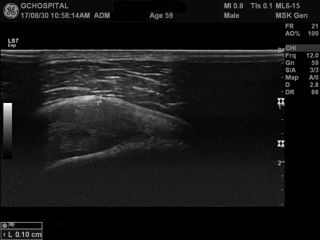 00125817_US_20170830276_20170830_002