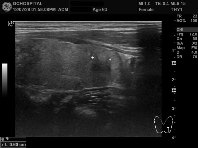 00153165_US_20180228377_20180228_003