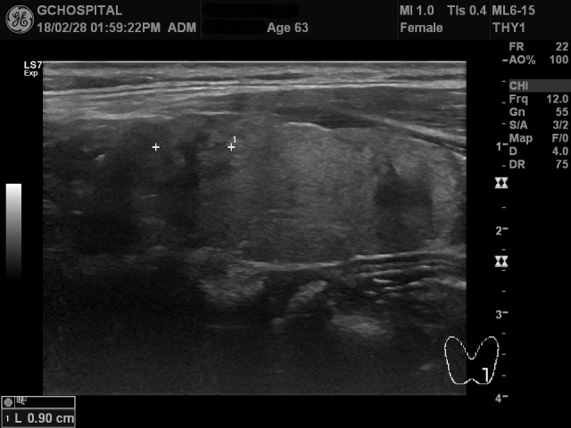 00153165_US_20180228377_20180228_004