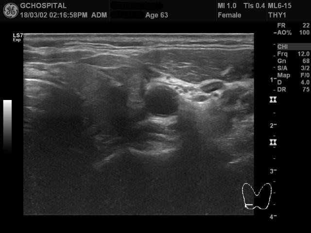 00153165_US_20180302354_20180302_001