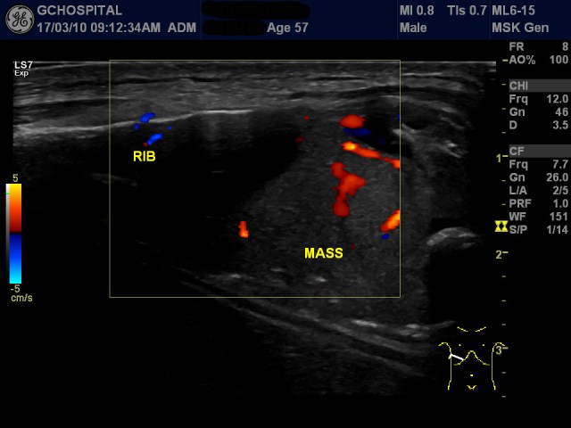 00219216_US_20170310108_20170310_005
