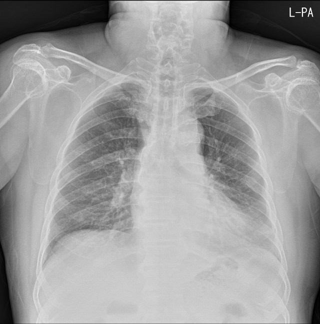 00079209_CR_20180307429_20180307_001