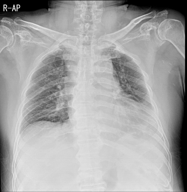 00079209_CR_20180403259_20180403_003