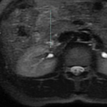 00199166_MR_2018041357_20180413_001