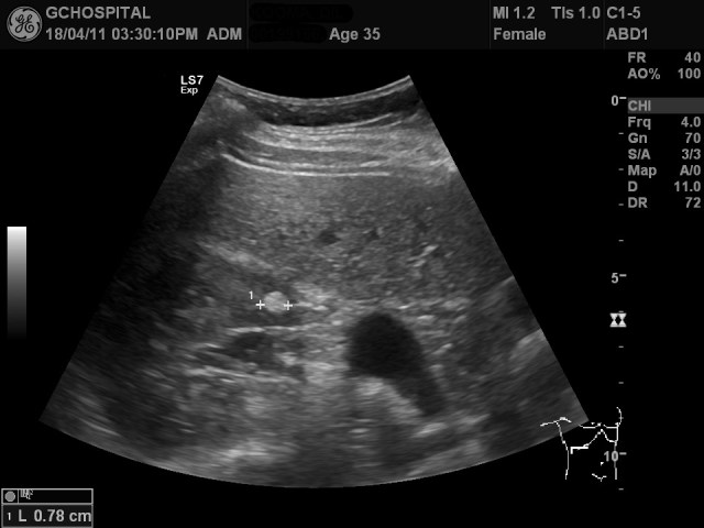 00199166_US_20180411474_20180411_003