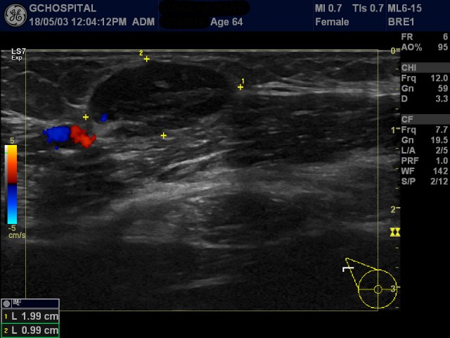 00104016_US_20180503270_20180503_002