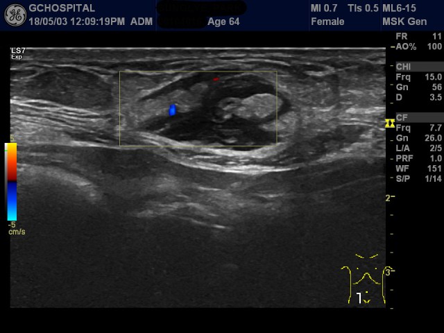 00104016_US_20180503270_20180503_004