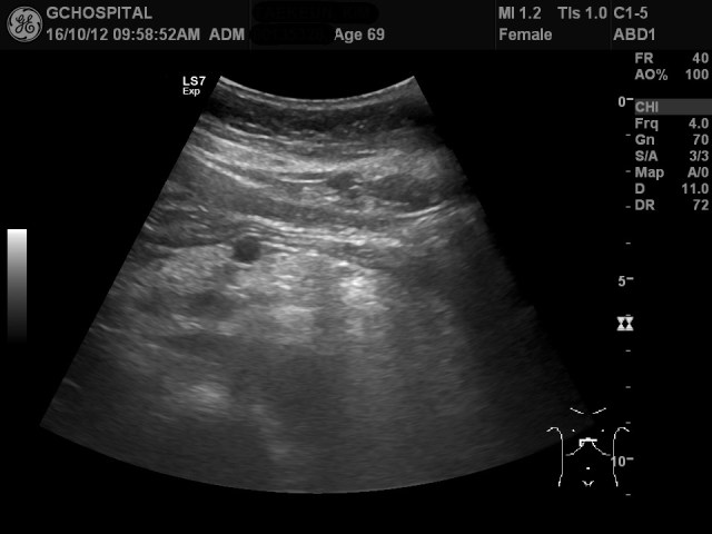 00135328_US_20161012217_20161012_004