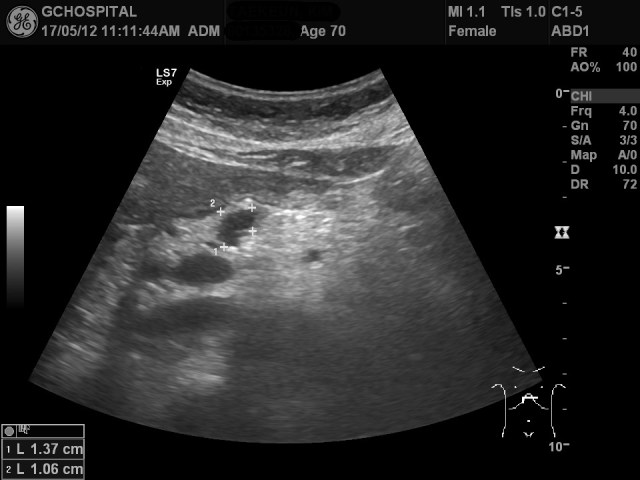 00135328_US_20170512225_20170512_003