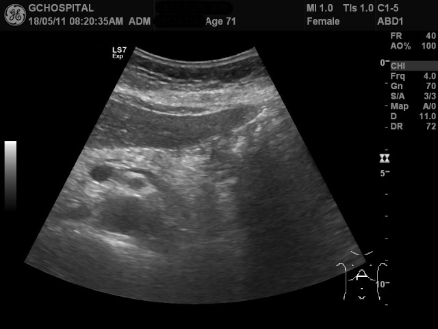 00135328_US_2018051149_20180511_001