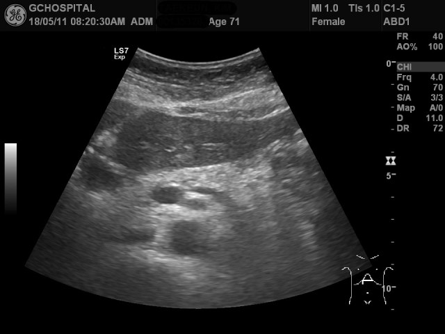 00135328_US_2018051149_20180511_002